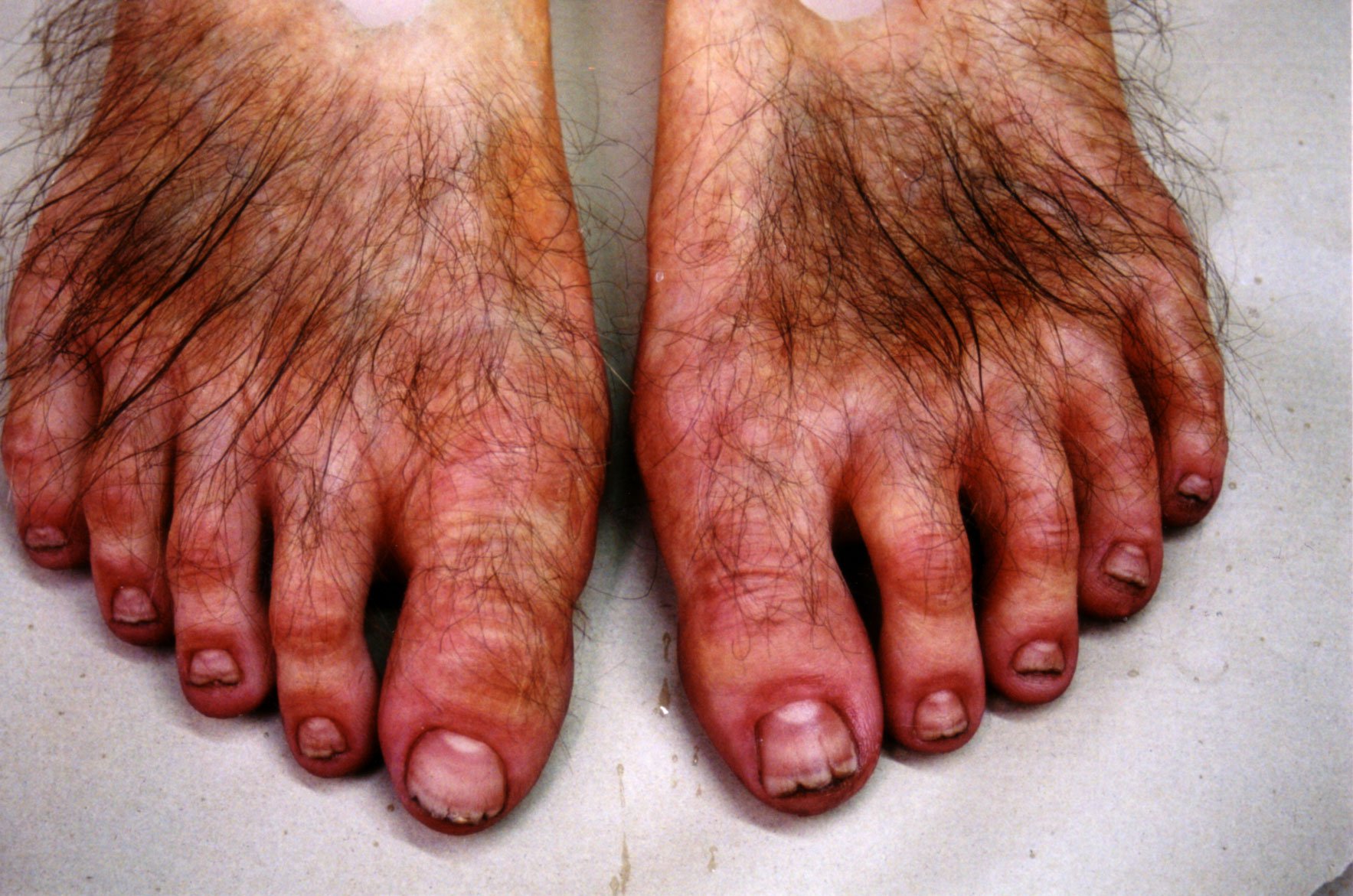 Serious Question Here Do Women Have foot Fetishes Like Us General 